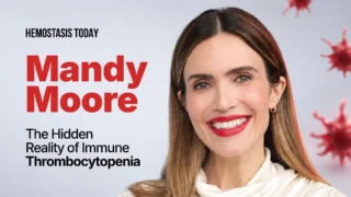 Mandy Moore’s Pregnancy Journey With Immune Thrombocytopenia