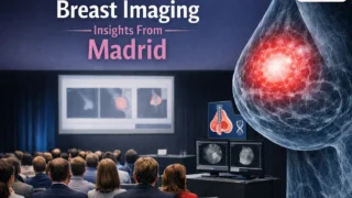 Breast Imaging Insights From Madrid - Swiss Journal of Radiology and Nuclear Medicine