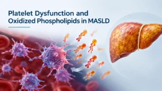 Lucia Stefanini: Platelet Dysfunction and Oxidized Phospholipids in MASLD