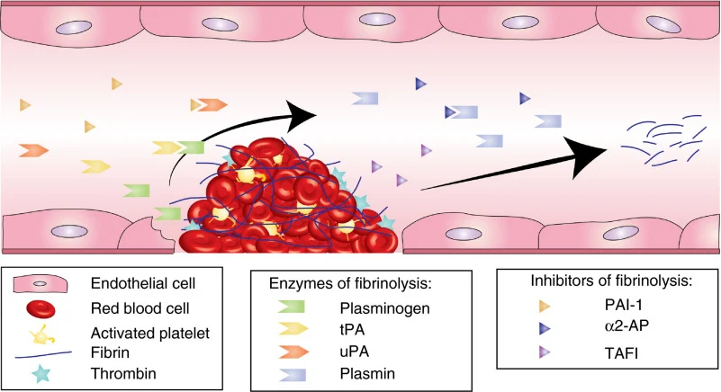 Hyperfibrinolysis